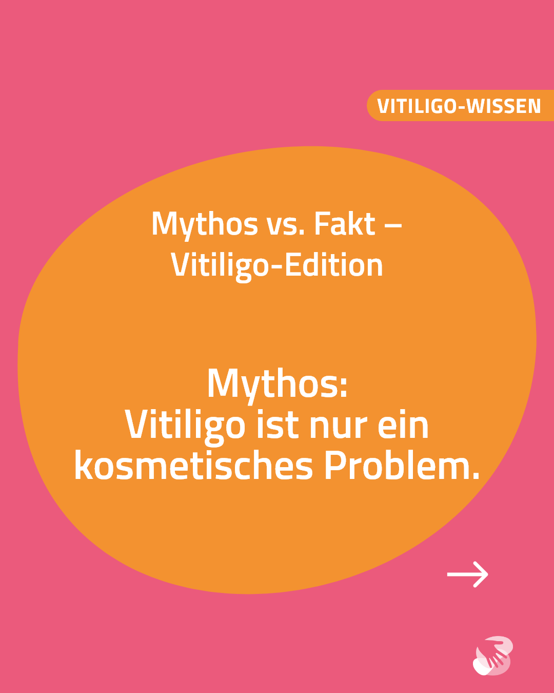 Mythos vs. Fakt Vitiligo-Edition
