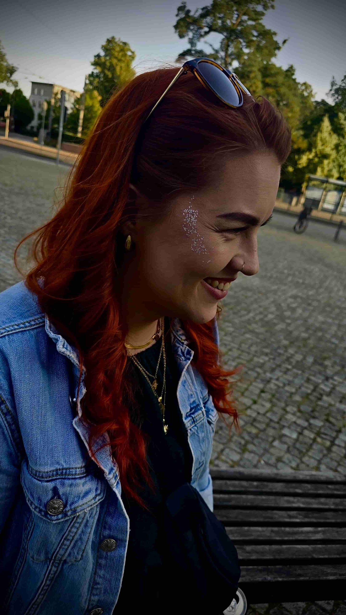 psoriasis betroffene berichten vanessa 2