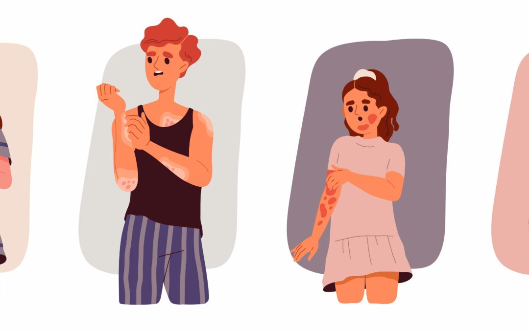 Psoriasis bei Kindern und Jugendlichen: Tipps für Eltern – Vom Experten Dr. Norbert Behnke