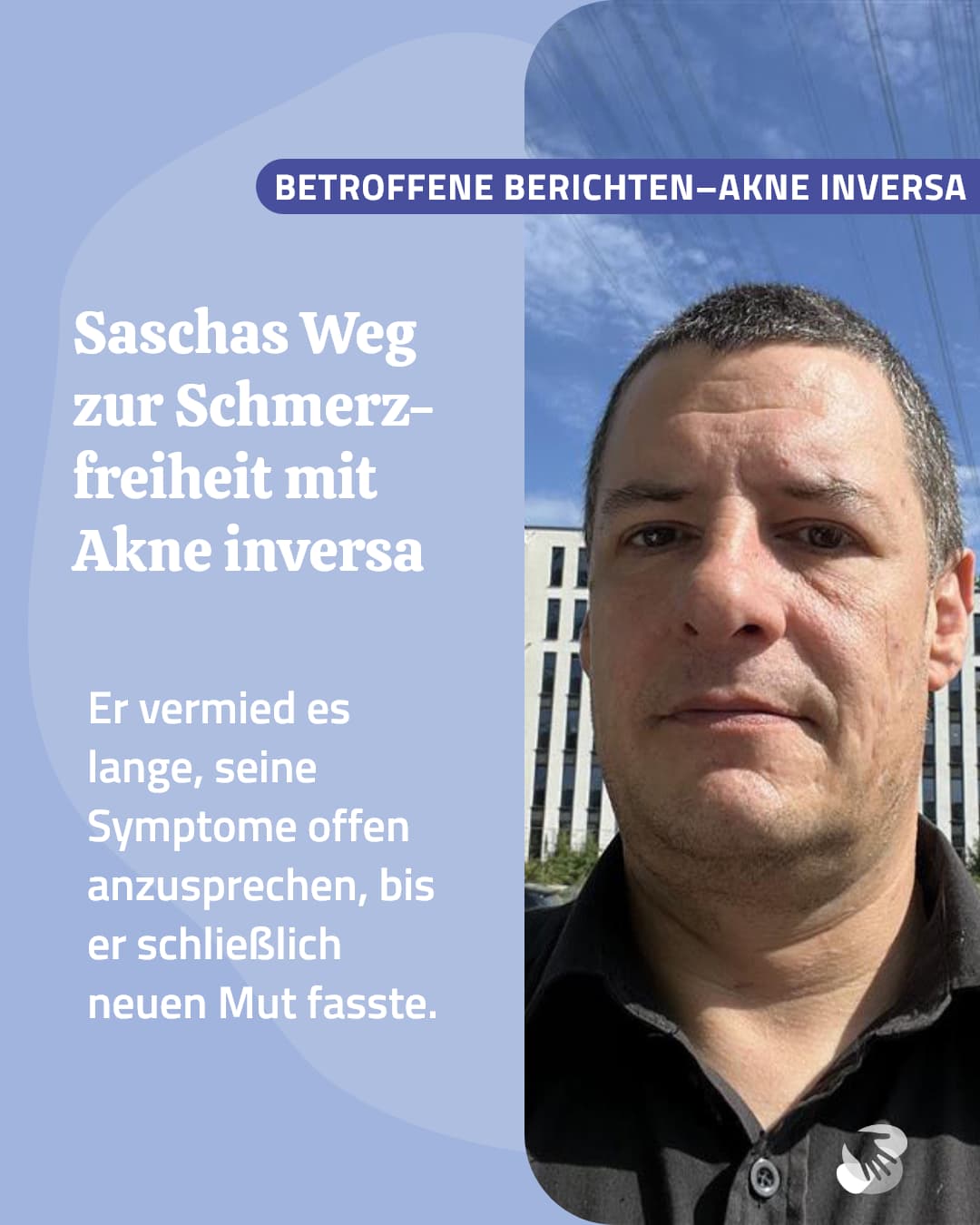 akne-inversa-saschas-geschichte-gesicht-von-sascha