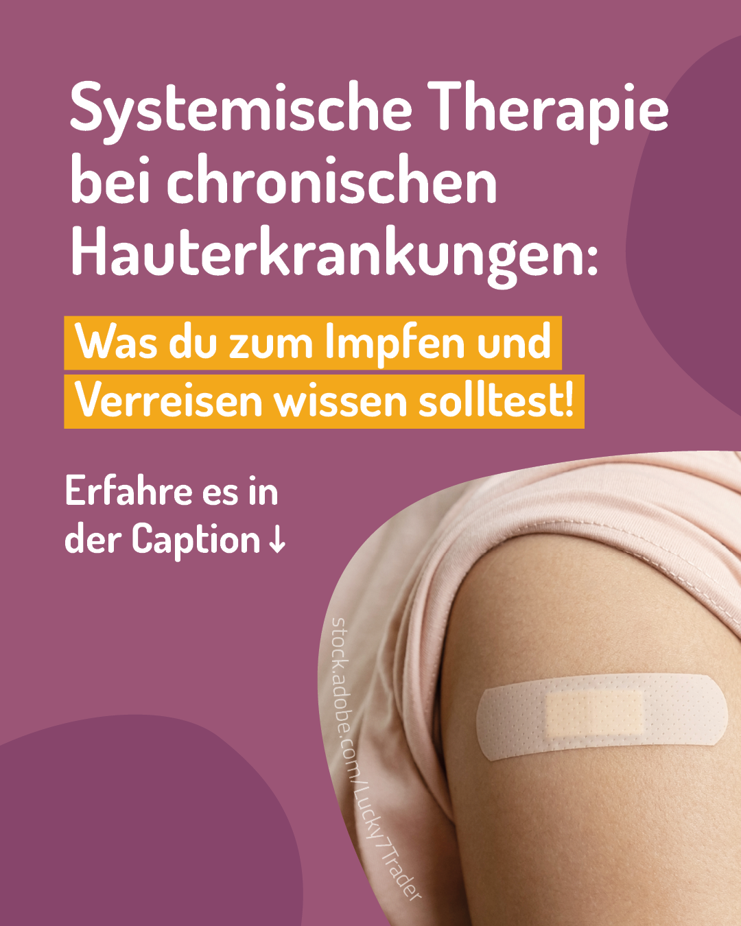 Neurodermitis Impfen und Verreisen mit systemischer Therapie