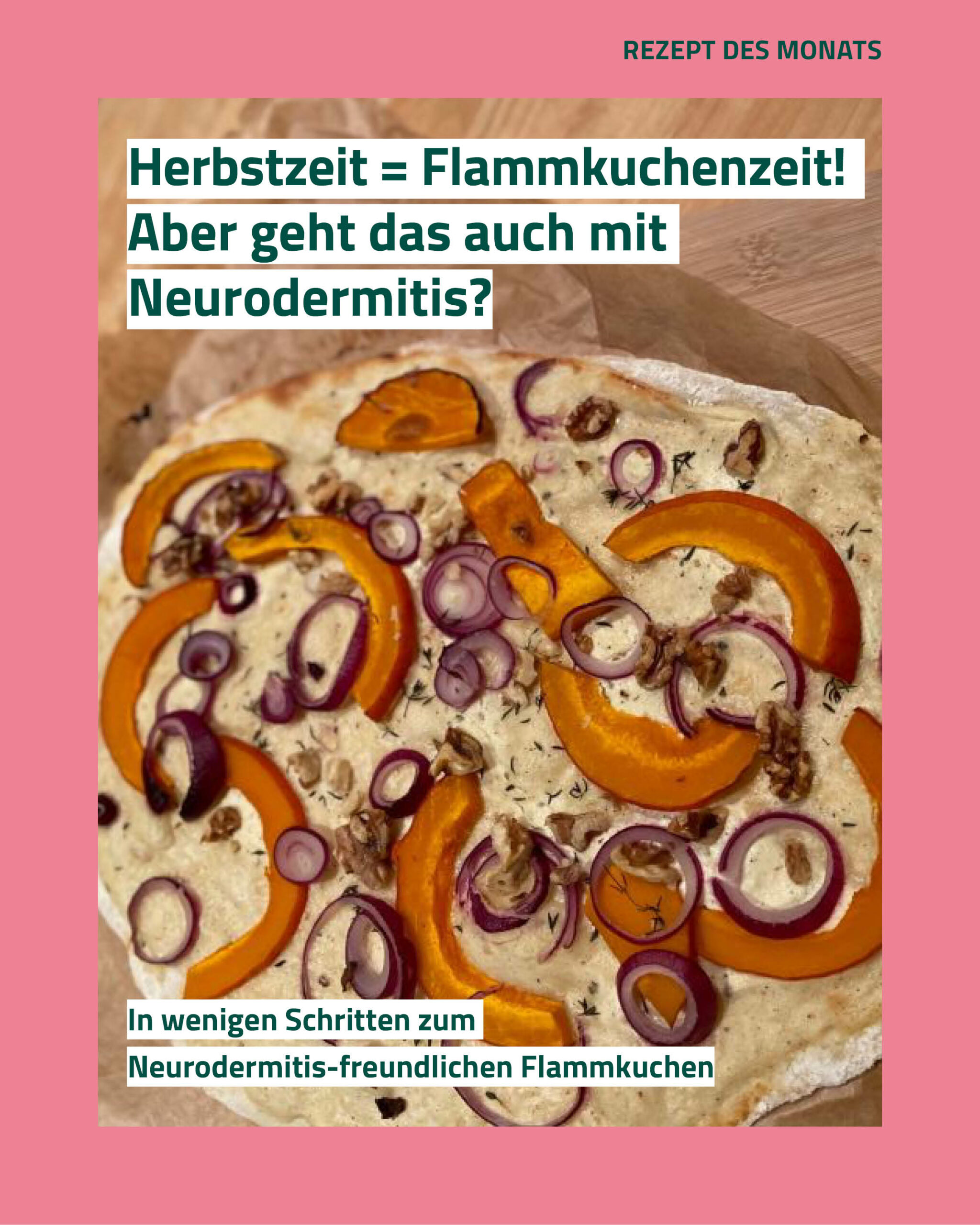 Flammkuchen bei Neurodermitis