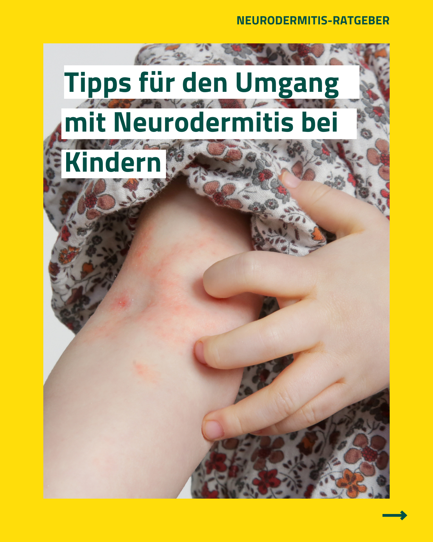 Kinder mit Neurodermitis