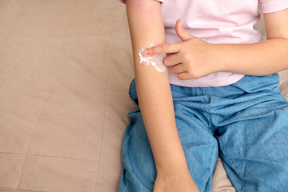 Neurodermitis bei Kindern und Jugendlichen – Interview mit Dermatologin Frau Khushboo Minni
