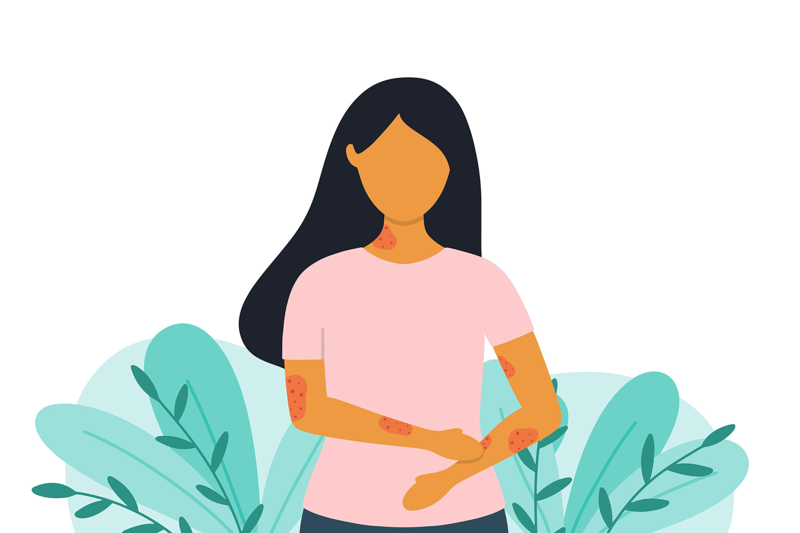 urtikaria-verstehen-illustration-frau-die-urtikaira-hat