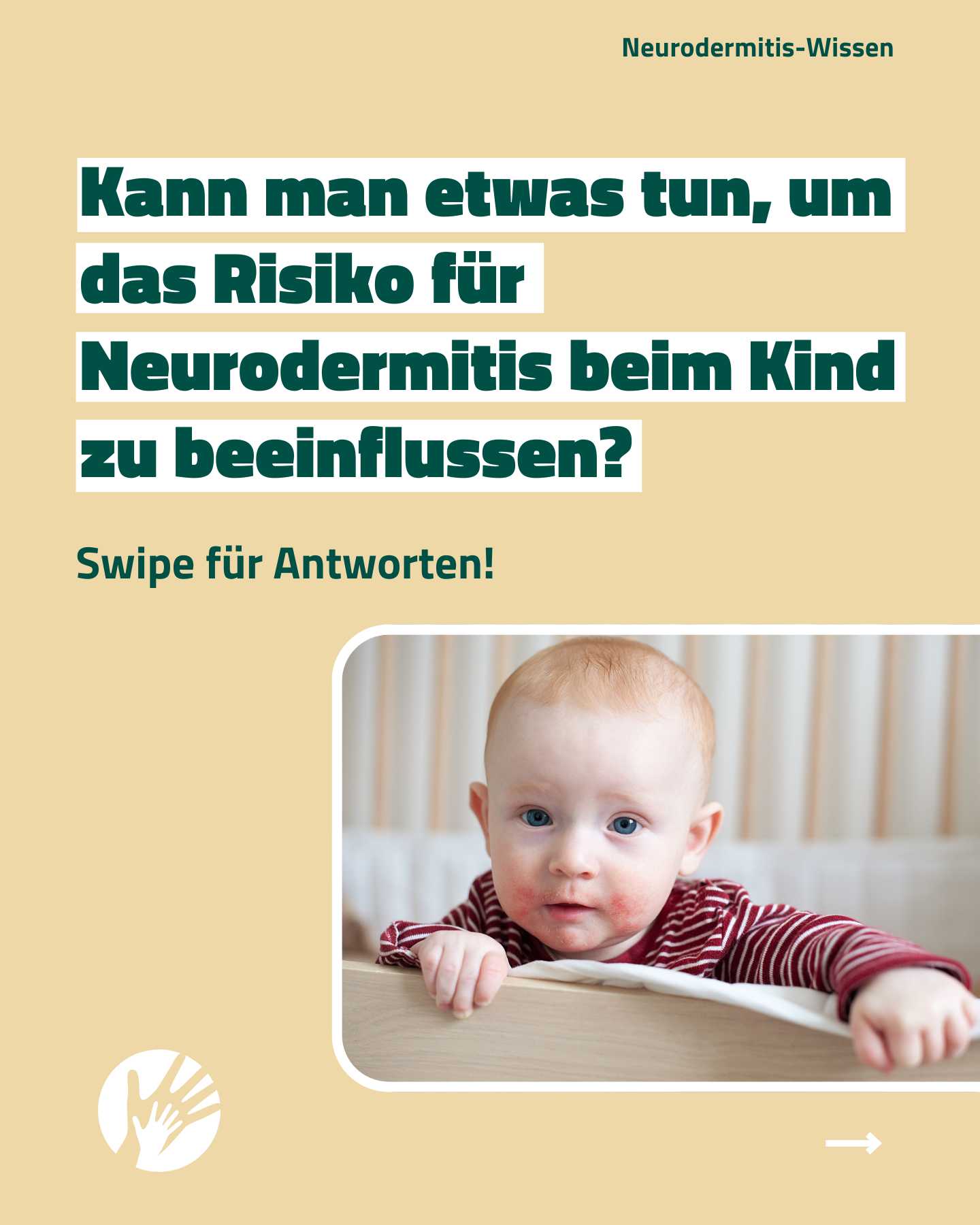neurodermitis-wissen-risiko-bei-kindern