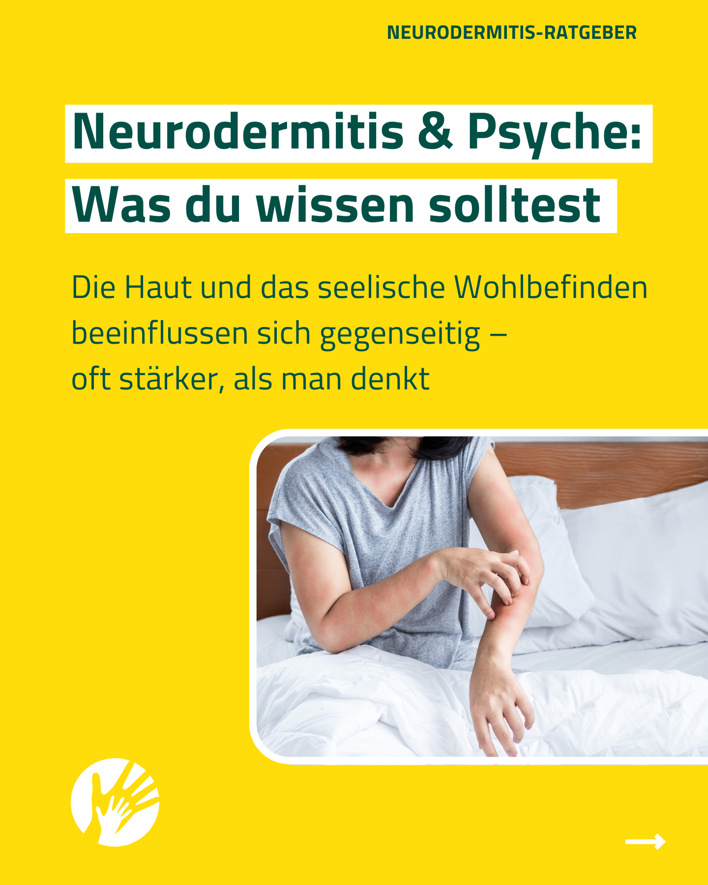 Neurodermitis und Psyche was du wissen solltest