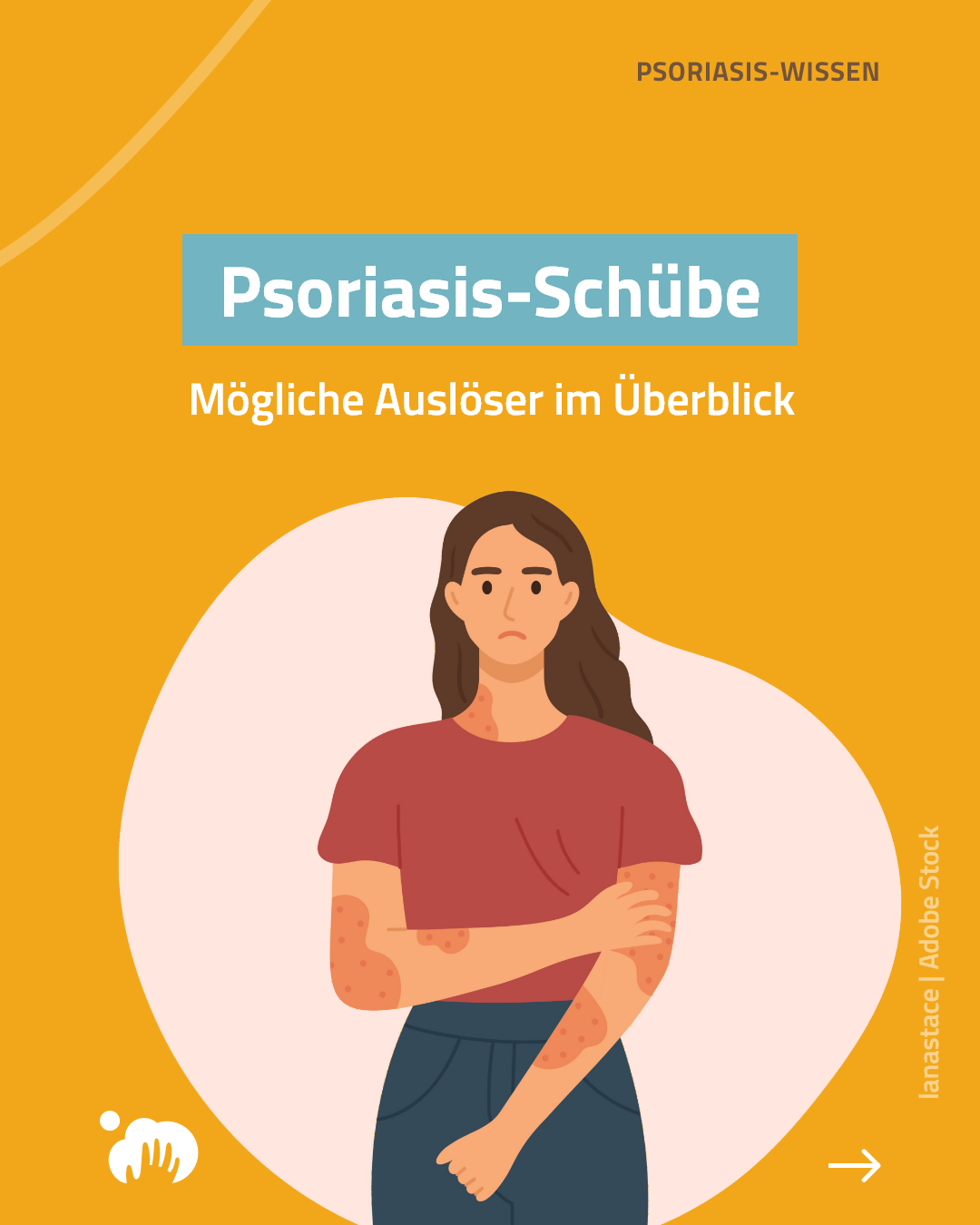 psoriasis-ig-post-februar-schübe