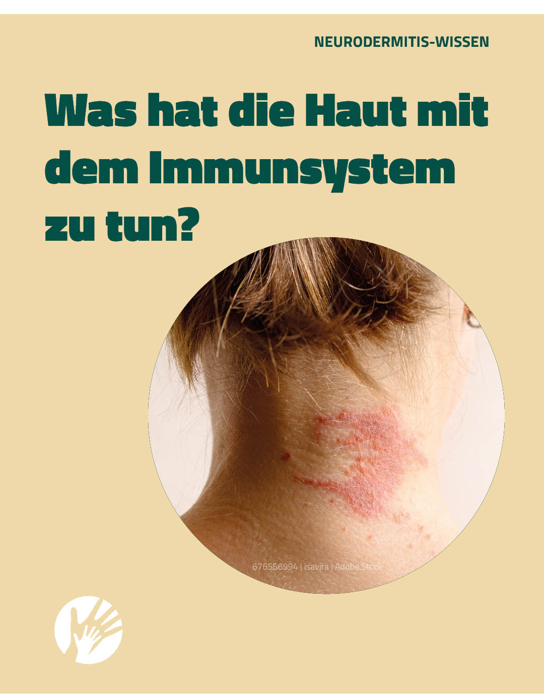 neurodermitits-ig-post-maerz-immunsystem